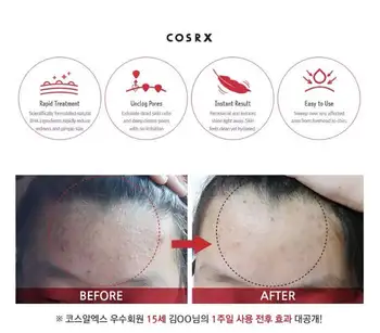 COSRX Üks Samm Algne Selge Pad 70ea / Karp Skin Care Eemaldada Poorid, Akne Plekk Ravi Näo Mask Originaal Korea Kosmeetika