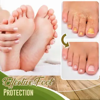 Seente Võidelda Feet Spray Anti seeninfektsiooni Sportlane Bakterite Villid Erosiooni Anti Beriberi Asjade Spray Koorimine Sügelema S4L9